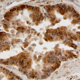 Immunohistochemistry Aldehyde Dehydrogenase 1-A1/ALDH1A1 Antibody [Unconjugated]