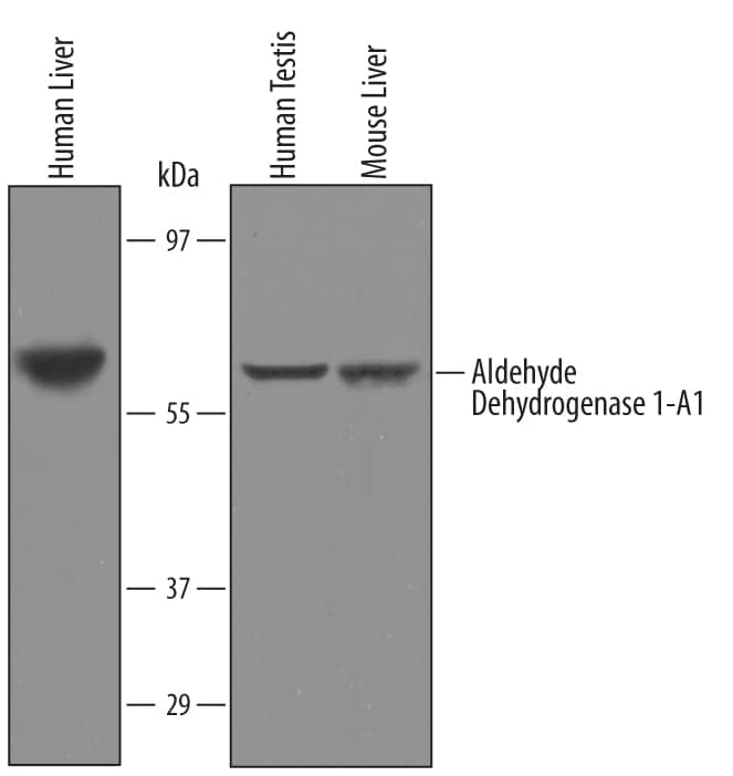 Western Blot Aldehyde Dehydrogenase 1-A1/ALDH1A1 Antibody [Unconjugated]