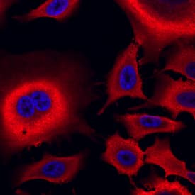 Immunocytochemistry Aldehyde Dehydrogenase 1-A1/ALDH1A1 Antibody (703410) [Unconjugated]