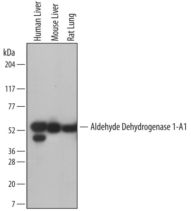 Western Blot Aldehyde Dehydrogenase 1-A1/ALDH1A1 Antibody (703410) [Unconjugated]