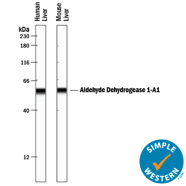 Simple Western lane view shows lysates of human liver tissue and mouse liver tissue, loaded at 0.2 mg/mL. A specific band was detected for Aldehyde Dehydrogenase 1-A1/ALDH1A1 at approximately 57 kDa (as indicated) using 10 µg/mL of Goat Anti-Human/Mouse Aldehyde Dehydrogenase 1-A1/ALDH1A1 Antigen Affinity-purified Polyclonal Antibody (Catalog # AF5869) followed by 1:50 dilution of HRP-conjugated Anti-Goat IgG Secondary Antibody (Catalog # HAF109). This experiment was conducted under reducing conditions and using the 12-230 kDa separation system.