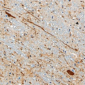 Immunohistochemistry Aldehyde Dehydrogenase 1-A1/ALDH1A1 Antibody (703410) [Unconjugated]