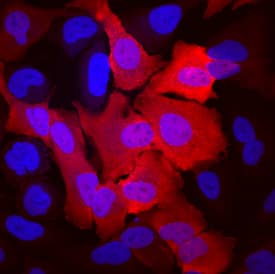 Aldehyde Dehydrogenase 3-A1/ALDH3A1 was detected in immersion fixed A549 human lung carcinoma cell line using Sheep Anti-Human Aldehyde Dehydrogenase 3-A1/ALDH3A1 Antigen Affinity-purified Polyclonal Antibody (Catalog # AF6705) at 10 µg/mL for 3 hours at room temperature. Cells were stained using the NorthernLights™ 557-conjugated Anti-Sheep IgG Secondary Antibody (red; Catalog # NL010) and counterstained with DAPI (blue). Specific staining was localized to cytoplasm and nuclei. View our protocol for Fluorescent ICC Staining of Cells on Coverslips.