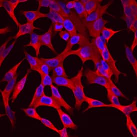 Aldo-keto Reductase 1C3/AKR1C3 was detected in immersion fixed LNCaP human prostate cancer cell line stimulated with 50 ng/mL Recombinant Human/Mouse/Rat ActivinA (Catalog # 338-AC) for 24 hrs using Mouse Anti-Human Aldo-keto Reductase 1C3/AKR1C3 Monoclonal Antibody (Catalog # MAB7678) at 10 µg/mL for 3 hours at room temperature. Cells were stained using the NorthernLights™ 557-conjugated Anti-Mouse IgG Secondary Antibody (red; Catalog # NL007) and counterstained with DAPI (blue). Specific staining was localized to cell surfaces and cytoplasm. View our protocol for Fluorescent ICC Staining of Cells on Coverslips.
