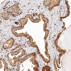 Aldo-keto Reductase 1C3/AKR1C3 was detected in immersion fixed paraffin-embedded sections of human prostate using Mouse Anti-Human Aldo-keto Reductase 1C3/AKR1C3 Monoclonal Antibody (Catalog # MAB7678) at 1.7 µg/mL for 1 hour at room temperature followed by incubation with the Anti-Mouse IgG VisUCyte™ HRP Polymer Antibody (Catalog # VC001). Tissue was stained using DAB (brown) and counterstained with hematoxylin (blue). Specific staining was localized to cytoplasm in epithelial cells. View our protocol for IHC Staining with VisUCyte HRP Polymer Detection Reagents.
