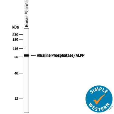 Simple Western lane view shows lysates of human placenta tissue, loaded at 0.2 mg/mL. A specific band was detected for Alkaline Phosphatase/ALPP/ALPI at approximately 76 kDa (as indicated) using 10 µg/mL of Sheep Anti-Human Alkaline Phosphatase/ALPP/ALPI Antigen Affinity-purified Polyclonal Antibody (Catalog # AF5905) followed by 1:50 dilution of HRP-conjugated Anti-Sheep IgG Secondary Antibody (Catalog # HAF016). This experiment was conducted under reducing conditions and using the 12-230 kDa separation system.