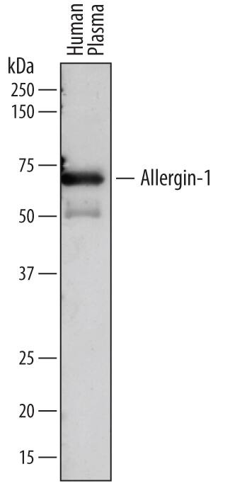 Western blot shows human plasma. PVDF membrane was probed with 0.5 µg/mL of Sheep Anti-Human Allergin-1 Antigen Affinity-purified Polyclonal Antibody (Catalog # AF7364) followed by HRP-conjugated Anti-Sheep IgG Secondary Antibody (Catalog # HAF016). A specific band was detected for Allergin-1 at approximately 70 kDa (as indicated). This experiment was conducted under reducing conditions and using Immunoblot Buffer Group 1.