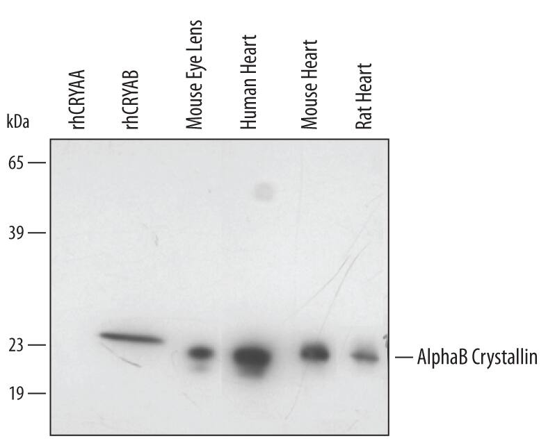 Western blot shows lysates of mouse eye lens and human, mouse, and rat heart tissue. PVDF membrane was probed with 0.2 µg/mL Human/Mouse/Rat AlphaB Crystallin/CRYAB Antigen Affinity-purified Polyclonal Antibody (Catalog # AF4849) followed by HRP-conjugated Anti-Goat IgG Secondary Antibody (Catalog # HAF017). For additional reference, recombinant human CRYAA and CRYAB (5 ng/lane) were included. A specific band for AlphaB Crystallin/CRYAB was detected at approximately 23 kDa (as indicated). This experiment was conducted under reducing conditions and using Immunoblot Buffer Group 2.