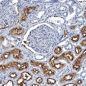 Aminopeptidase N/CD13 was detected in immersion fixed paraffin-embedded sections of human kidney using Sheep Anti-Human Aminopeptidase N/CD13 Antigen Affinity-purified Polyclonal Antibody (Catalog # AF3815) at 0.3 µg/mL overnight at 4 °C. Tissue was stained using the Anti-Sheep HRP-DAB Cell & Tissue Staining Kit (brown; Catalog # CTS019) and counterstained with hematoxylin (blue). Specific staining was localized to convoluted tubules. View our protocol for Chromogenic IHC Staining of Paraffin-embedded Tissue Sections.
