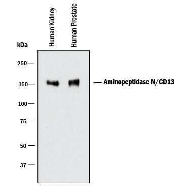 Western blot shows lysates of human kidney tissue and human prostate tissue. PVDF membrane was probed with 0.5 µg/mL of Sheep Anti-Human Aminopeptidase N/CD13 Antigen Affinity-purified Polyclonal Antibody (Catalog # AF3815) followed by HRP-conjugated Anti-Sheep IgG Secondary Antibody (Catalog # HAF016). A specific band was detected for Aminopeptidase N/CD13 at approximately 150 kDa (as indicated). This experiment was conducted under reducing conditions and using Immunoblot Buffer Group 1.