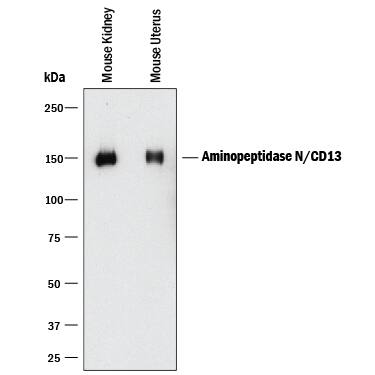 Western blot shows lysates of mouse kidney tissue and mouse uterus tissue. PVDF membrane was probed with 1 µg/mL of Rat Anti-Mouse Aminopeptidase N/CD13 Monoclonal Antibody (Catalog # MAB2335) followed by HRP-conjugated Anti-Rat IgG Secondary Antibody (Catalog # HAF005). A specific band was detected for Aminopeptidase N/CD13 at approximately 150 kDa (as indicated). This experiment was conducted under reducing conditions and using Immunoblot Buffer Group 1.