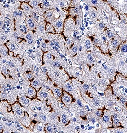 Aminopeptidase N/CD13 was detected in immersion fixed paraffin-embedded sections of human colon using Mouse Anti-Human Aminopeptidase N/CD13 Monoclonal Antibody (Catalog # MAB38151) at 0.5 µg/mL for 1 hour at room temperature followed by incubation with the Anti-Mouse IgG VisUCyte™ HRP Polymer Antibody (Catalog # VC001). Before incubation with the primary antibody, tissue was subjected to heat-induced epitope retrieval using Antigen Retrieval Reagent-Basic (Catalog # CTS013). Tissue was stained using DAB (brown) and counterstained with hematoxylin (blue). Specific staining was localized to glandular cells. View our protocol for IHC Staining with VisUCyte HRP Polymer Detection Reagents.