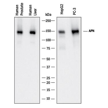 Western blot shows lysates of human prostate tissue, human liver tissue, HepG2 human hepatocellular carcinoma cell line, and PC-3 human prostate cancer cell line. PVDF membrane was probed with 1 µg/mL of Mouse Anti-Human Aminopeptidase N/CD13 Monoclonal Antibody (Catalog # MAB38151) followed by HRP-conjugated Anti-Mouse IgG Secondary Antibody (Catalog # HAF018). A specific band was detected for Aminopeptidase N/CD13 at approximately 150 kDa (as indicated). This experiment was conducted under reducing conditions and using Immunoblot Buffer Group 1.