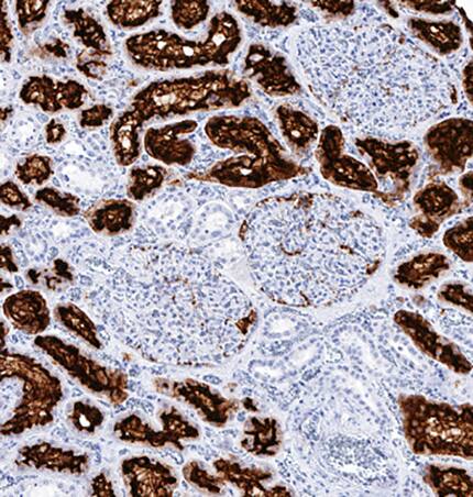 Aminopeptidase N/CD13 was detected in immersion fixed paraffin-embedded sections of human kidney using Mouse Anti-Human Aminopeptidase N/CD13 Monoclonal Antibody (Catalog # MAB38152) at 0.5 µg/mL for 1 hour at room temperature followed by incubation with the Anti-Mouse IgG VisUCyte™ HRP Polymer Antibody (Catalog # VC001). Before incubation with the primary antibody, tissue was subjected to heat-induced epitope retrieval using Antigen Retrieval Reagent-Basic (Catalog # CTS013). Tissue was stained using DAB (brown) and counterstained with hematoxylin (blue). Specific staining was localized to cytoplasm in convoluted tubules. View our protocol for IHC Staining with VisUCyte HRP Polymer Detection Reagents.