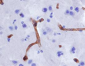 Aminopeptidase N/CD13 was detected in immersion fixed paraffin-embedded sections of human brain (cortex) using Mouse Anti-Human Aminopeptidase N/CD13 Monoclonal Antibody (Catalog # MAB3815) at 1.7 µg/mL overnight at 4 °C. Tissue was stained using the Anti-Mouse HRP-DAB Cell & Tissue Staining Kit (brown; Catalog # CTS002) and counterstained with hematoxylin (blue). Specific staining was localized to blood vessels. View our protocol for Chromogenic IHC Staining of Paraffin-embedded Tissue Sections.