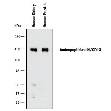 Western blot shows lysates of human kidney tissue and human prostate tissue. PVDF membrane was probed with 2 µg/mL of Mouse Anti-Human Aminopeptidase N/CD13 Monoclonal Antibody (Catalog # MAB3815) followed by HRP-conjugated Anti-Mouse IgG Secondary Antibody (Catalog # HAF018). A specific band was detected for Aminopeptidase N/CD13 at approximately 150 kDa (as indicated). This experiment was conducted under reducing conditions and using Immunoblot Buffer Group 1.