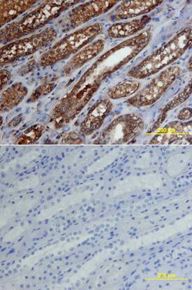 Aminopeptidase O/ONPEP was detected in immersion fixed paraffin-embedded sections of human kidney array using Human Aminopeptidase O/ONPEP Monoclonal Antibody (Catalog # MAB4647) at 15 µg/mL overnight at 4 °C. Tissue was stained using the Anti-Mouse HRP-DAB Cell & Tissue Staining Kit (brown; Catalog # CTS002) and counterstained with hematoxylin (blue). Lower panel shows a lack of labeling if primary antibodies are omitted and tissue is stained only with secondary antibody followed by incubation with detection reagents. View our protocol for Chromogenic IHC Staining of Paraffin-embedded Tissue Sections.