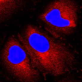 Immunocytochemistry Aminopeptidase PILS/ARTS1 Antibody [Unconjugated]