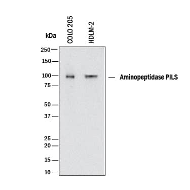Western Blot Aminopeptidase PILS/ARTS1 Antibody [Unconjugated]