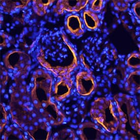 Amnionless was detected in perfusion fixed frozen sections of mouse kidney using Sheep Anti-Mouse Amnionless Antigen Affinity-purified Polyclonal Antibody (Catalog # AF7139) at 15 µg/mL overnight at 4 °C. Tissue was stained using the NorthernLights™ 557-conjugated Anti-Sheep IgG Secondary Antibody (red; Catalog # NL010) and counterstained with DAPI (blue). Specific staining was localized to convoluted tubules. View our protocol for Fluorescent IHC Staining of Frozen Tissue Sections.