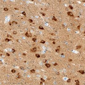Amphiphysin/AMPH was detected in immersion fixed paraffin-embedded sections of human brain (cortex) using Mouse Anti-Human Amphiphysin/AMPH Monoclonal Antibody (Catalog # MAB6527) at 15 µg/mL overnight at 4 °C. Before incubation with the primary antibody, tissue was subjected to heat-induced epitope retrieval using Antigen Retrieval Reagent-Basic (Catalog # CTS013). Tissue was stained using the Anti-Mouse HRP-DAB Cell & Tissue Staining Kit (brown; Catalog # CTS002) and counterstained with hematoxylin (blue). Specific staining was localized to neuronal cell bodies. View our protocol for Chromogenic IHC Staining of Paraffin-embedded Tissue Sections.