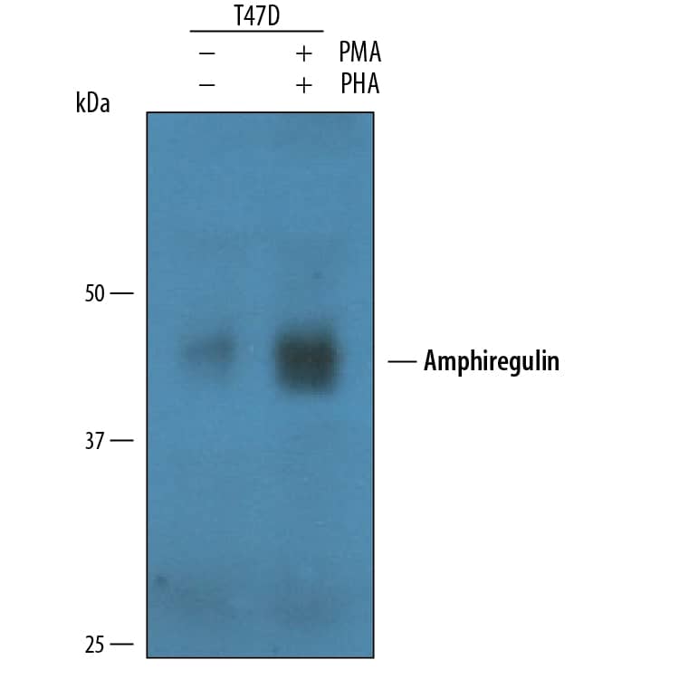 Western blot shows conditioned media from T47D human breast cancer cell line untreated (-) or treated (+) with PMA and PHA for 3 days. PVDF membrane was probed with 1 µg/mL of Goat Anti-Human Amphiregulin Antigen Affinity-purified Polyclonal Antibody (Catalog # AF262) followed by HRP-conjugated Anti-Goat IgG Secondary Antibody (Catalog # HAF109). A specific band was detected for Amphiregulin at approximately 45 kDa (as indicated). This experiment was conducted under reducing conditions and using Immunoblot Buffer Group 1.