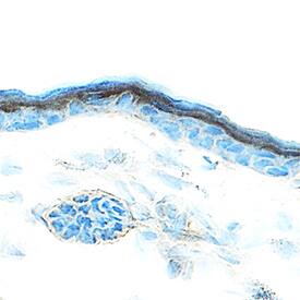 Amphiregulin was detected in immersion fixed frozen sections of mouse skin using Goat Anti-Mouse Amphiregulin Antigen Affinity-purified Polyclonal Antibody (Catalog # AF989) at 15 µg/mL overnight at 4 °C. Tissue was stained using the Anti-Goat HRP-DAB Cell & Tissue Staining Kit (brown; Catalog # CTS008) and counterstained with hematoxylin (blue). Specific staining was localized to keratinocytes. View our protocol for Chromogenic IHC Staining of Frozen Tissue Sections.