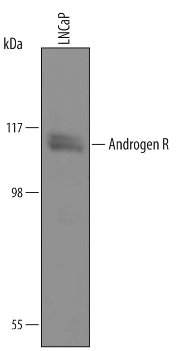 Western blot shows lysates of LNCaP human prostate cancer cell line. PVDF Membrane was probed with 1 µg/mL of Sheep Anti-Human/Mouse/Rat Androgen R/NR3C4 Antigen Affinity-purified Polyclonal Antibody (Catalog # AF5876) followed by HRP-conjugated Anti-Sheep IgG Secondary Antibody (Catalog # HAF016). A specific band was detected for Androgen R/NR3C4 at approximately 115 kDa (as indicated). This experiment was conducted under reducing conditions using Immunoblot Buffer Group 8.