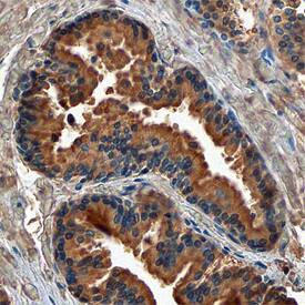 Androgen R/NR3C4 was detected in immersion fixed paraffin-embedded sections of human prostate using Mouse Anti-Human/Mouse/Rat Androgen R/NR3C4 Monoclonal Antibody (Catalog # MAB58761) at 15 µg/mL overnight at 4 °C. Before incubation with the primary antibody, tissue was subjected to heat-induced epitope retrieval using Antigen Retrieval Reagent-Basic (Catalog # CTS013). Tissue was stained using the Anti-Mouse HRP-DAB Cell & Tissue Staining Kit (brown; Catalog # CTS002) and counterstained with hematoxylin (blue). Specific staining was localized to cytoplasm of glandular epithelial cells. View our protocol for Chromogenic IHC Staining of Paraffin-embedded Tissue Sections.