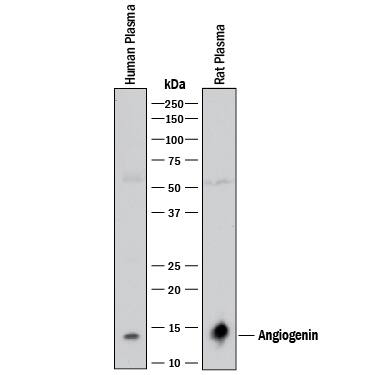 Western Blot Angiogenin Antibody [Unconjugated]