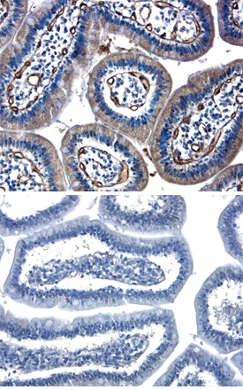 Immunohistochemistry Angiopoietin-2 Antibody [Unconjugated]