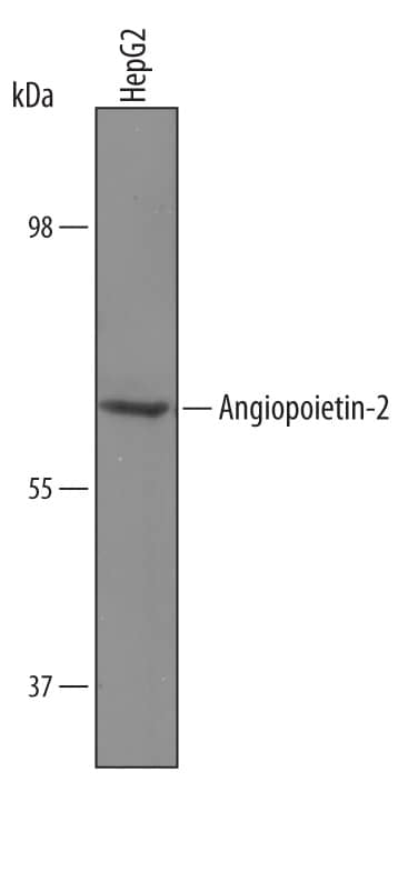 Western Blot Angiopoietin-2 Antibody [Unconjugated]