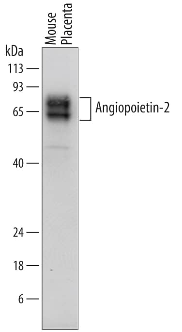 Western blot shows lysates of mouse placenta tissue. PVDF membrane was probed with 0.2 µg/mL of Sheep Anti-Mouse Angiopoietin-2 Antigen Affinity-purified Polyclonal Antibody (Catalog # AF7186) followed by HRP-conjugated Anti-Sheep IgG Secondary Antibody (Catalog # HAF016). Specific bands were detected for Angiopoietin-2 at approximately 60 to 75 kDa (as indicated). This experiment was conducted under reducing conditions and using Immunoblot Buffer Group 1.