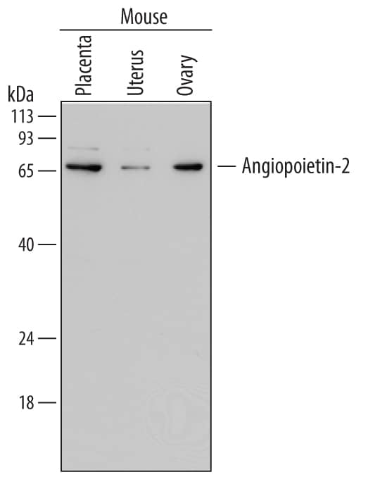 Western blot shows lysates of mouse placenta tissue, mouse uterus tissue, and mouse ovary tissue. PVDF membrane was probed with 2 µg/mL of Rat Anti-Mouse Angiopoietin-2 Monoclonal Antibody (Catalog # MAB7186) followed by HRP-conjugated Anti-Rat IgG Secondary Antibody (Catalog # HAF005). A specific band was detected for Angiopoietin-2 at approximately 68 kDa (as indicated). This experiment was conducted under reducing conditions and using Immunoblot Buffer Group 1.