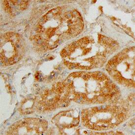 Angiopoietin-4 was detected in immersion fixed paraffin-embedded sections of human kidney using Human Angiopoietin-4 Monoclonal Antibody (Catalog # MAB964) at 15 µg/mL overnight at 4 °C. Before incubation with the primary antibody, tissue was subjected to heat-induced epitope retrieval using Antigen Retrieval Reagent-Basic (Catalog # CTS013). Tissue was stained using the Anti-Mouse HRP-DAB Cell & Tissue Staining Kit (brown; Catalog # CTS002) and counterstained with hematoxylin (blue). View our protocol for Chromogenic IHC Staining of Paraffin-embedded Tissue Sections.