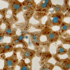 Angiopoietin-like 3 was detected in perfusion fixed frozen sections of mouse liver using Goat Anti-Mouse Angiopoietin-like 3 Antigen Affinity-purified Polyclonal Antibody (Catalog # AF136) at 5 µg/mL overnight at 4 °C. Tissue was stained using the Anti-Goat HRP-DAB Cell & Tissue Staining Kit (brown; Catalog # CTS008) and counterstained with hematoxylin (blue). Specific labeling was localized to the cytoplasm of hepatocytes. View our protocol for Chromogenic IHC Staining of Frozen Tissue Sections.