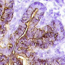 Immunohistochemistry Angiopoietin-1 Antibody [Unconjugated]