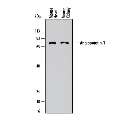 Western Blot Angiopoietin-1 Antibody (892732)