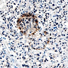 Immunohistochemistry Angiopoietin-1 Antibody (171718) [Unconjugated]