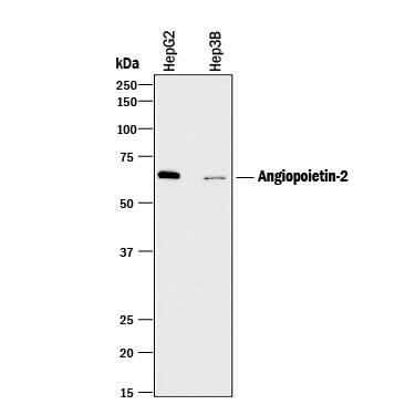 Western blot shows lysates of HepG2 human hepatocellular carcinoma cell line and Hep3B human hepatocellular carcinoma cell line. PVDF membrane was probed with 2 µg/mL of Goat Anti-Human Angiopoietin-2 Polyclonal Antibody (Catalog # AB623) followed by HRP-conjugated Anti-Goat IgG Secondary Antibody (Catalog # HAF017). A specific band was detected for Angiopoietin-2 at approximately 65 kDa (as indicated). This experiment was conducted under reducing conditions and using Immunoblot Buffer Group 1.