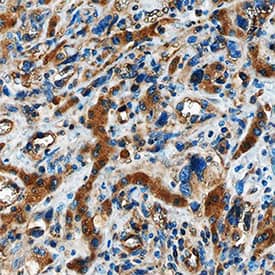 Immunohistochemistry Angiopoietin-2 Antibody [Unconjugated]