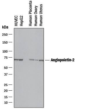 Western blot shows lysates of HUVEC human umbilical vein endothelial cells, HepG2 human hepatocellular carcinoma cell line, human placenta tissue, human ovary tissue, and human uterus tissue. PVDF membrane was probed with 0.5 µg/mL of Mouse Anti-Human Angiopoietin-2 Monoclonal Antibody (Catalog # MAB0983) followed by HRP-conjugated Anti-Mouse IgG Secondary Antibody (Catalog # HAF018). A specific band was detected for Angiopoietin-2 at approximately 70 kDa (as indicated). This experiment was conducted under reducing conditions and using Immunoblot Buffer Group 1.