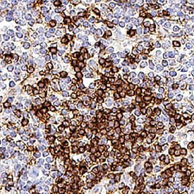 Immunohistochemistry Angiopoietin-2 Antibody (85816) [Unconjugated]