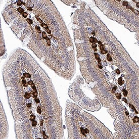 Immunohistochemistry Angiopoietin-2 Antibody (85816) [Unconjugated]