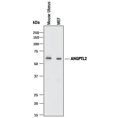 Western Blot Angiopoietin-like Protein 2/ANGPTL2 Antibody [Unconjugated]