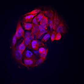 Angiopoietin-like Protein 8/Betatrophin was detected in immersion fixed HepG2 human hepatocellular carcinoma cell line using Mouse Anti-Human Angiopoietin-like Protein 8/Betatrophin Monoclonal Antibody (Catalog # MAB8548) at 10 µg/mL for 3 hours at room temperature. Cells were stained using the NorthernLights™ 557-conjugated Anti-Mouse IgG Secondary Antibody (red; Catalog # NL007) and counterstained with DAPI (blue). View our protocol for Fluorescent ICC Staining of Cells on Coverslips.