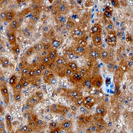 Angiopoietin-like Protein 8/Betatrophin was detected in immersion fixed paraffin-embedded sections of human liver using Mouse Anti-Human Angiopoietin-like Protein 8/Betatrophin Antigen Affinity-purified Monoclonal Antibody (Catalog # MAB8548) at 15 µg/mL overnight at 4 °C. Tissue was stained using the Anti-Mouse HRP-DAB Cell & Tissue Staining Kit (brown; Catalog # CTS002) and counterstained with hematoxylin (blue). Specific staining was localized to hepatocytes. View our protocol for Chromogenic IHC Staining of Paraffin-embedded Tissue Sections.