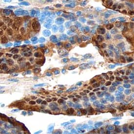 Annexin A10 was detected in immersion fixed paraffin-embedded sections of human stomach using Goat Anti-Human Annexin A10 Antigen Affinity-purified Polyclonal Antibody (Catalog # AF3544) at 10 µg/mL overnight at 4 °C. Before incubation with the primary antibody, tissue was subjected to heat-induced epitope retrieval using Antigen Retrieval Reagent-Basic (Catalog # CTS013). Tissue was stained using the Anti-Goat HRP-DAB Cell & Tissue Staining Kit (brown; Catalog # CTS008) and counterstained with hematoxylin (blue). Specific staining was localized to nuclei of epithelial cells. View our protocol for Chromogenic IHC Staining of Paraffin-embedded Tissue Sections.