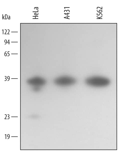 Western blot shows lysates of HeLa human cervical epithelial carcinoma cell line, A431 human epithelial carcinoma cell line, and K562 human chronic myelogenous leukemia cell line. PVDF membrane was probed with 0.5 µg/mL of Human Annexin A10 Antigen Affinity-purified Polyclonal Antibody (Catalog # AF3544) followed by HRP-conjugated Anti-Goat IgG Secondary Antibody (Catalog # HAF109). A specific band was detected for Annexin A10 at approximately 37 kDa (as indicated). This experiment was conducted using Immunoblot Buffer Group 2.