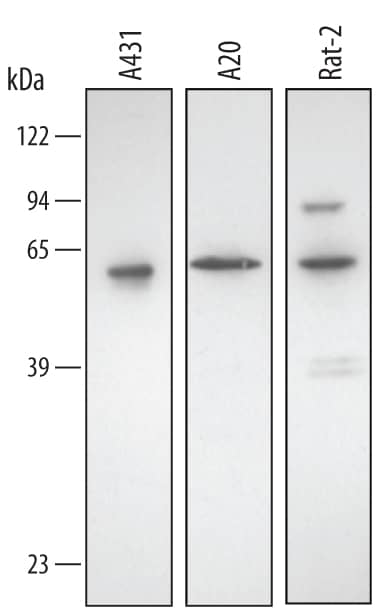 Western Blot Annexin A11 Antibody [Unconjugated]